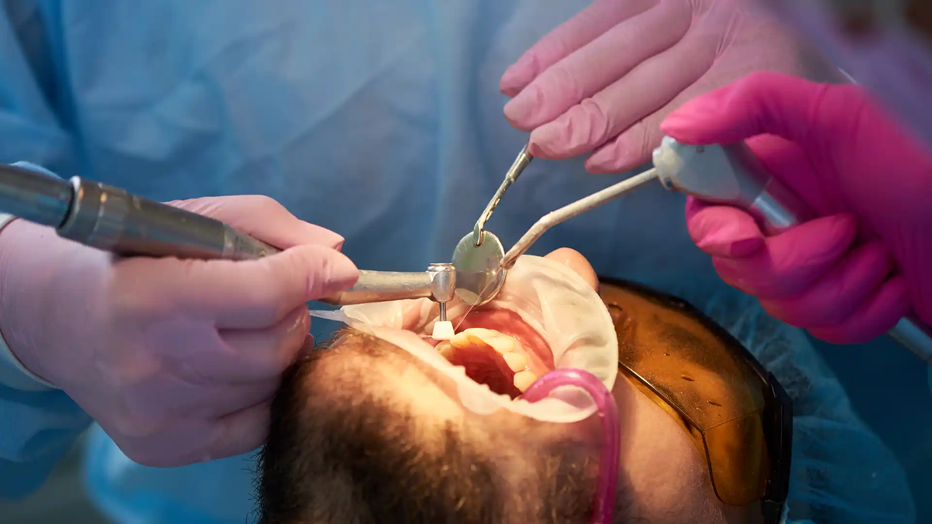 Jaw Surgery Turkey